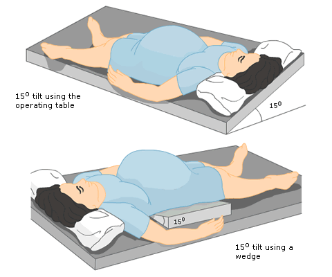 Positioning the Patient