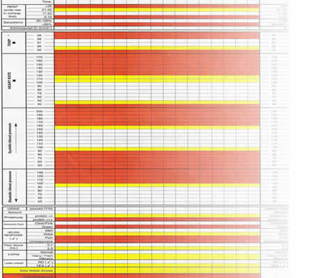 Ews Chart